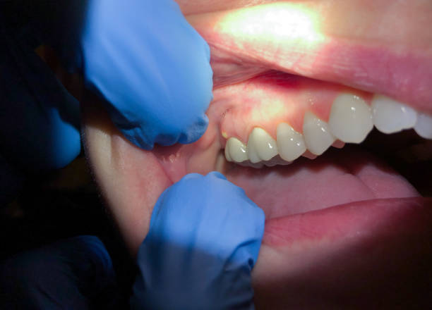 Best Emergency TMJ Treatment in Shingle Springs, CA