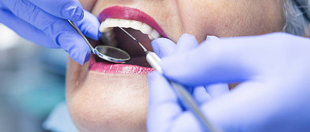 Best Pediatric Emergency Dentist in Shingle Springs, CA